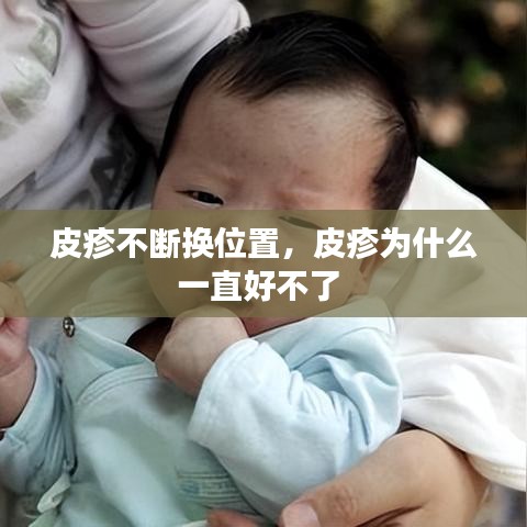 皮疹不断换位置，皮疹为什么一直好不了 