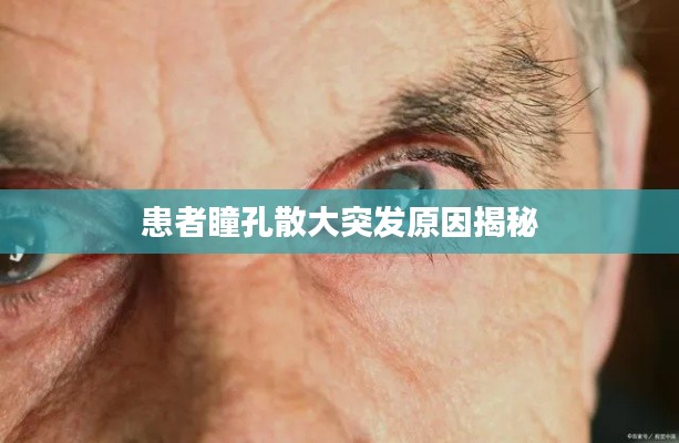 患者瞳孔散大突发原因揭秘