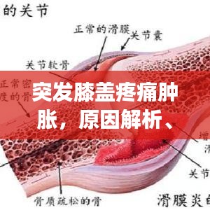 突发膝盖疼痛肿胀，原因解析、应急处理与预防策略